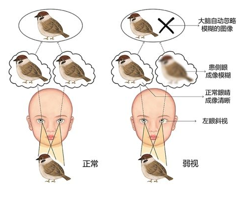 驗光師培訓(xùn)學(xué)校，正真視光學(xué)院